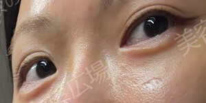 治療結果の症例写真