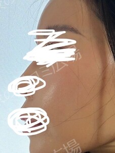 治療前の症例写真