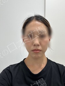 治療前の症例写真