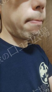 治療前の症例写真