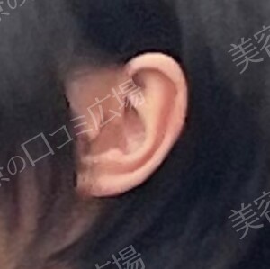 治療前の症例写真