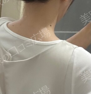治療前の症例写真