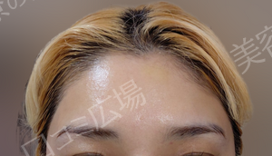 治療結果の症例写真
