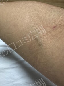 治療前の症例写真