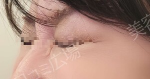 治療結果の症例写真