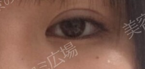 治療前の症例写真