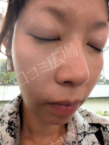 治療結果の症例写真