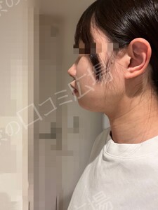 治療前の症例写真