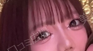 治療結果の症例写真