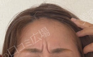 治療前の症例写真