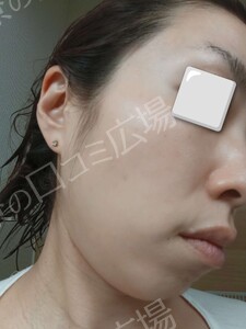 治療結果の症例写真