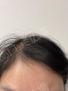 治療結果の症例写真