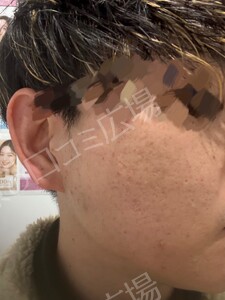 治療前の症例写真