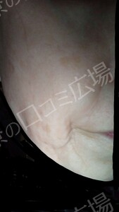 治療前の症例写真