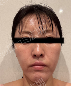 治療前の症例写真