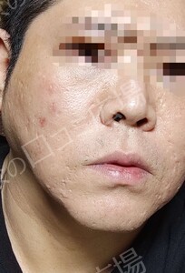 治療前の症例写真