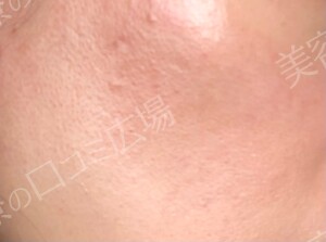 治療前の症例写真