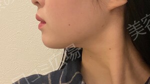 治療前の症例写真