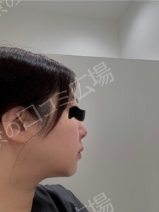 治療前の症例写真