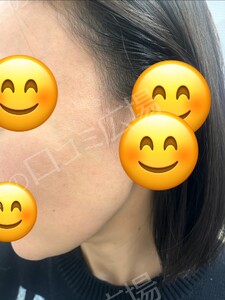 治療前の症例写真