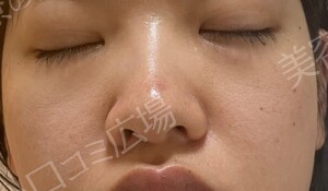 治療前の症例写真