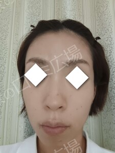治療前の症例写真