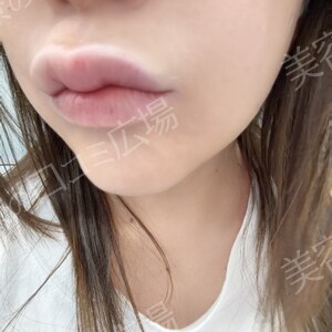 治療結果の症例写真