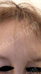 治療前の症例写真