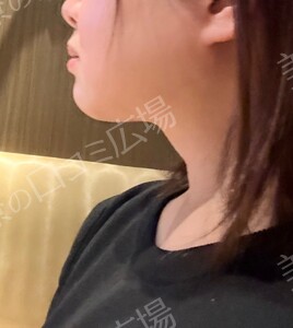治療結果の症例写真
