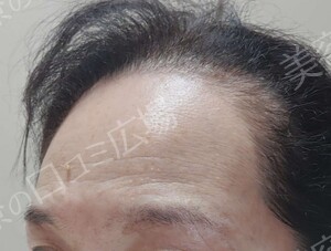 治療結果の症例写真