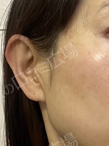 治療結果の症例写真