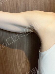 治療結果の症例写真