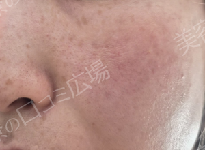 治療結果の症例写真