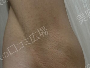 治療前の症例写真