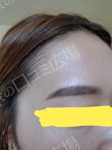 治療前の症例写真