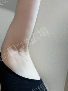 治療結果の症例写真