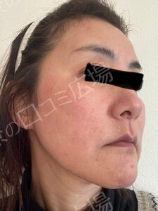 治療結果の症例写真
