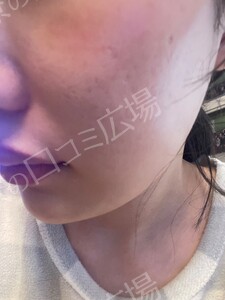 治療前の症例写真