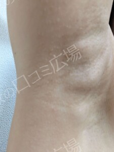 治療結果の症例写真