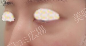 治療結果の症例写真
