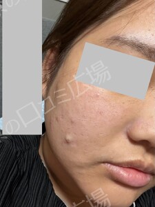 治療結果の症例写真