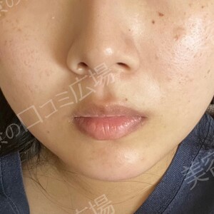 治療結果の症例写真