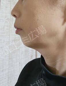 治療前の症例写真