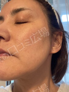 治療前の症例写真