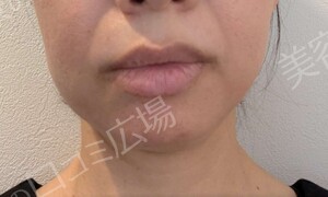 さっぽろ美容クリニック 本院の症例写真[アフター]