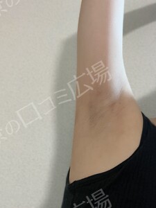 治療結果の症例写真