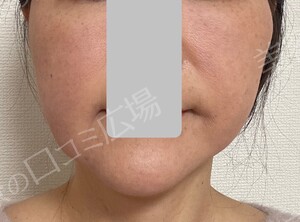 治療結果の症例写真