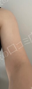 治療前の症例写真