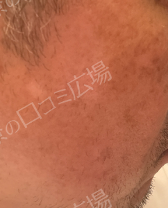 治療結果の症例写真