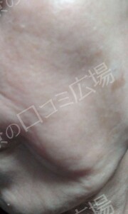 治療結果の症例写真